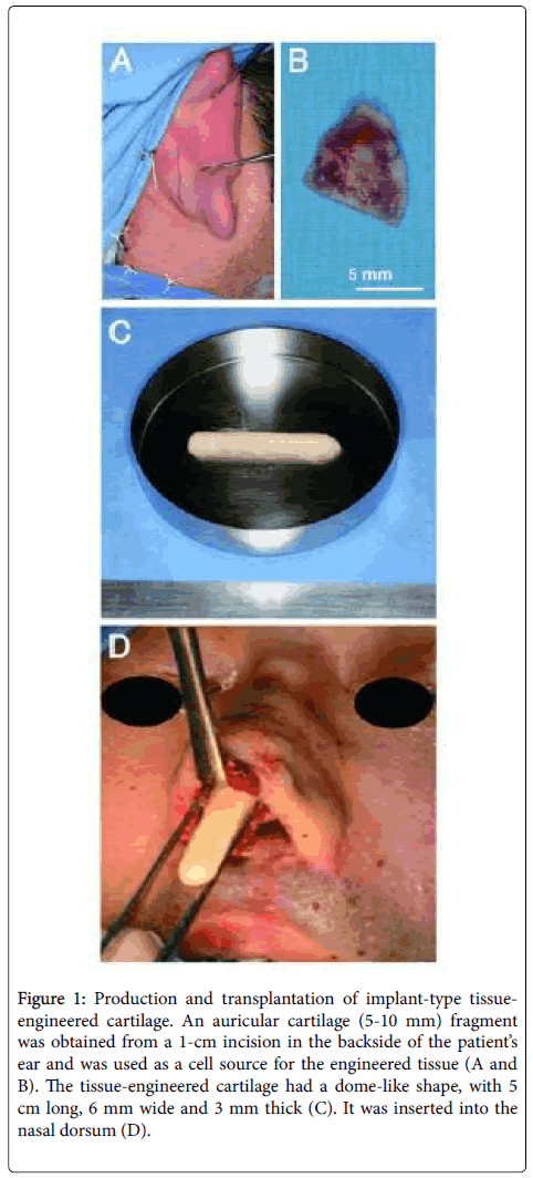 clinical-trials-auricular-cartilage