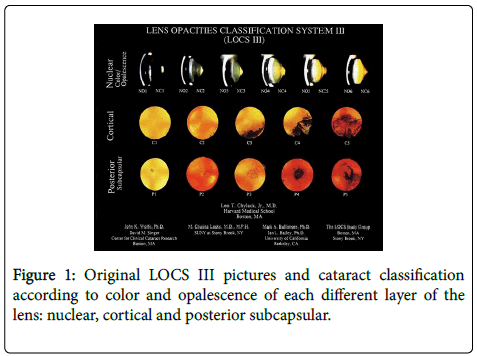clinical-trials-cataract-classification