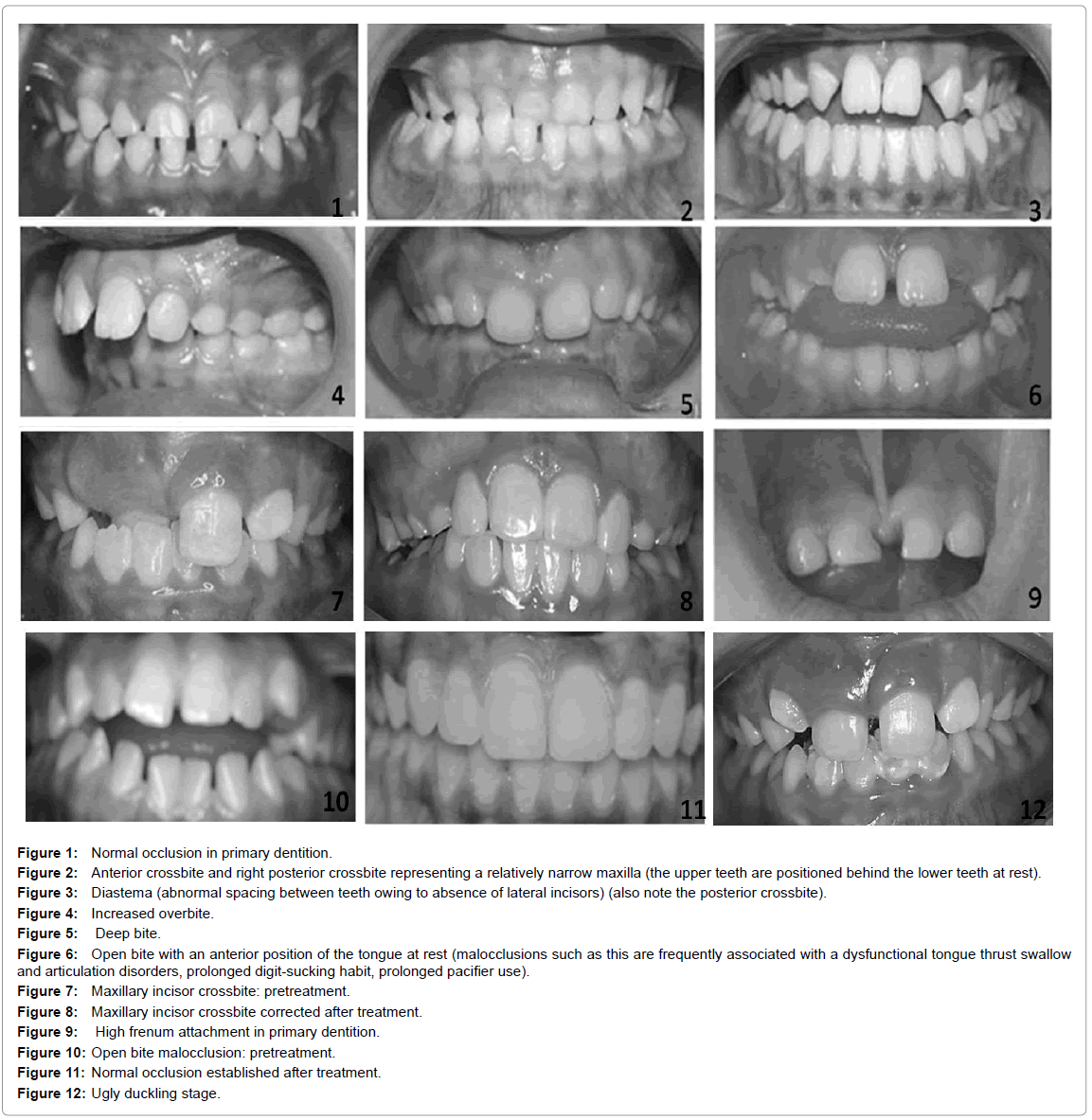 clinical-trials-primary-dentition