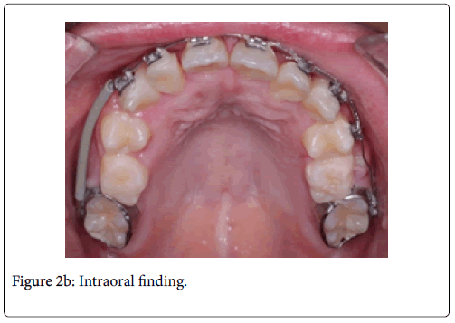 clinical-trials-therapy-Intraoral-finding