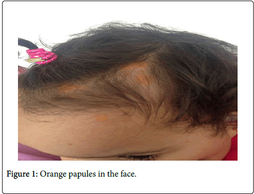 clinical-trials-therapy-Orange-papules