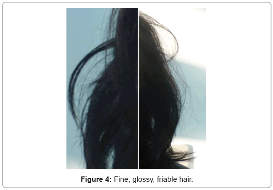PDF A Case of Tufted Hair Folliculititis  Semantic Scholar