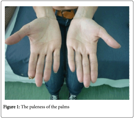drug-designing-paleness-palms