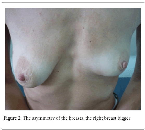 drug-designing-right-breast-bigger