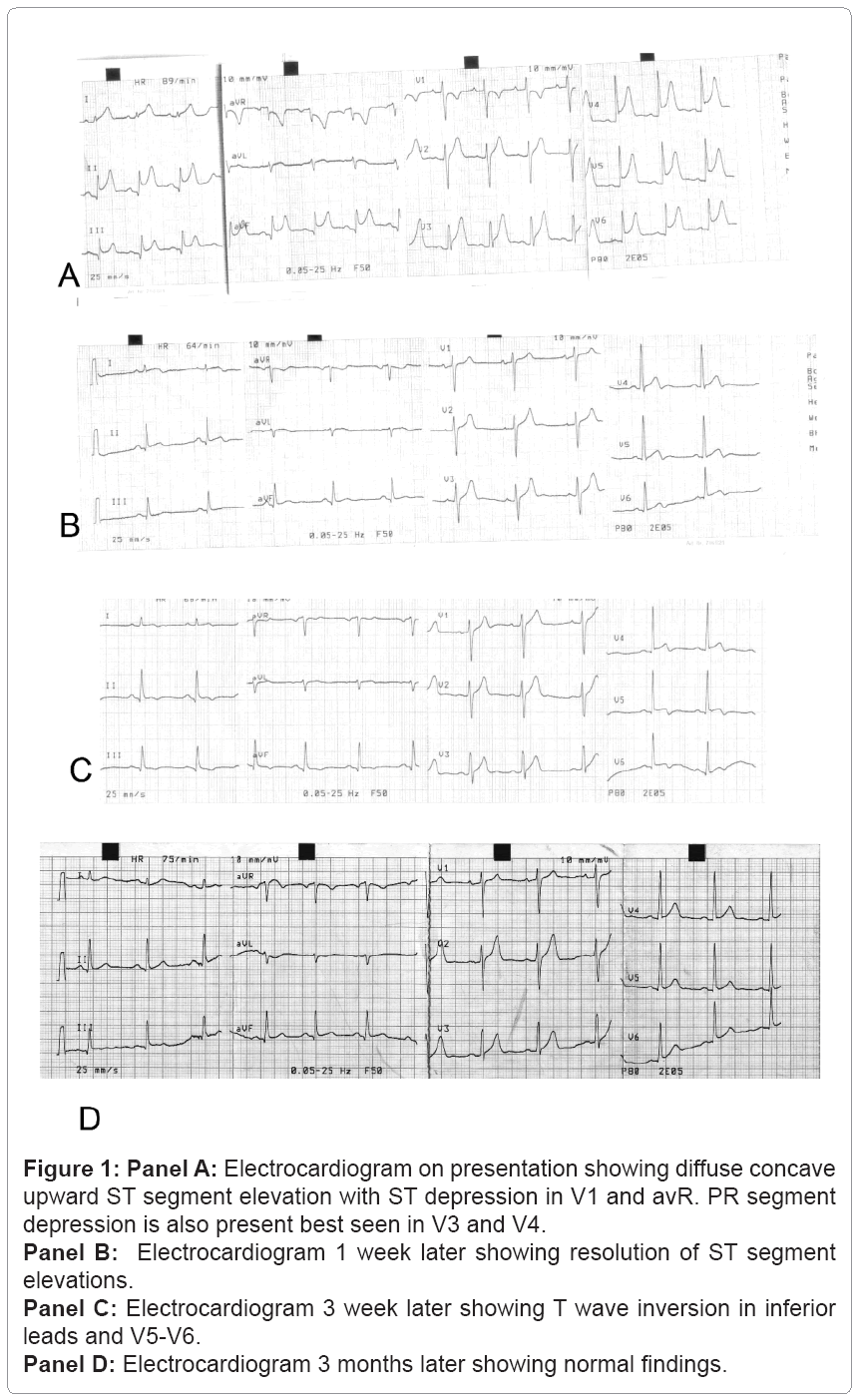 emergency-medicine-Electrocardiogram