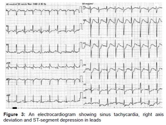 emergency-medicine-an-electrocardiogram-sinus