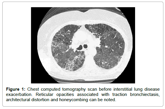 emergency-medicine-chest-computed-tomography
