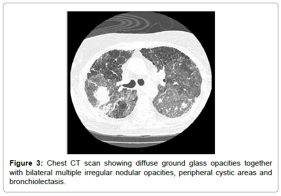 emergency-medicine-chest-ct-scan-diffuse