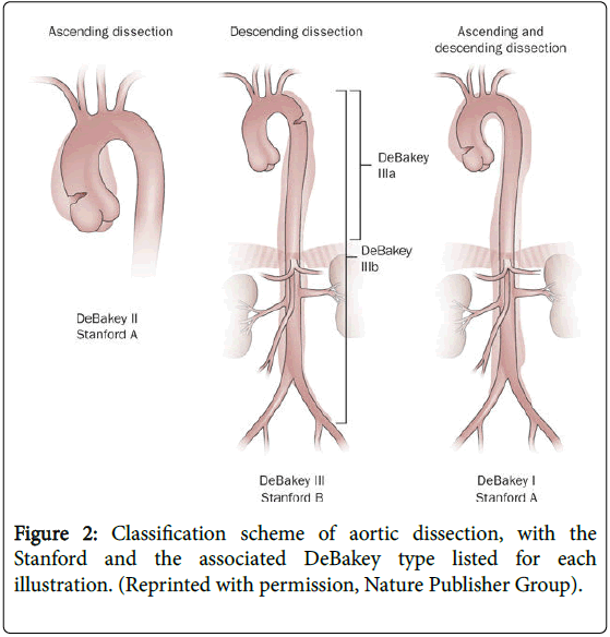 emergency-medicine-classification-scheme-aortic