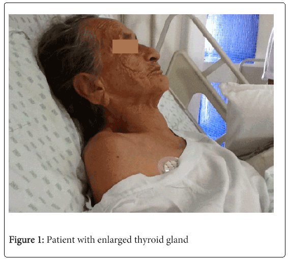 emergency-medicine-enlarged-thyroid-gland