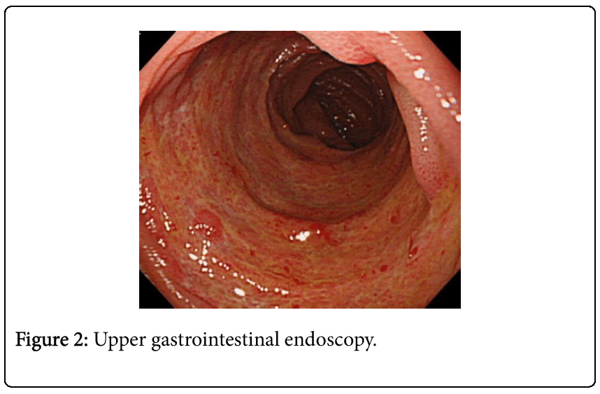 emergency-medicine-gastrointestinal-endoscopy