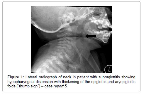 emergency-medicine-lateral-radiograph