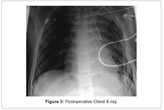 emergency-medicine-postoperative-chest-x-ray