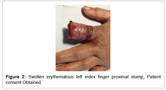 emergency-medicine-swollen-erythematous