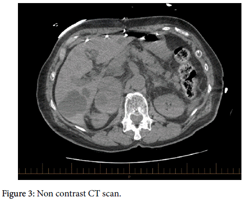 endocrinology-metabolic-syndrome-Non-contrast-CT-scan