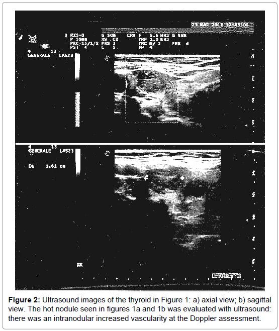 endocrinology-metabolic-syndrome-Ultrasound-images