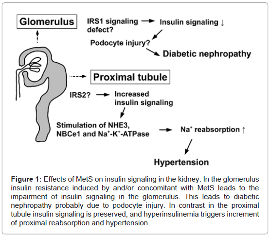 endocrinology-metabolic-syndrome-insulin-signaling