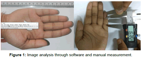 ergonomics-Image-analysis