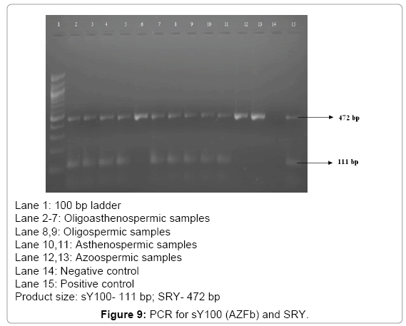 fertilization-in-vitro-sY100