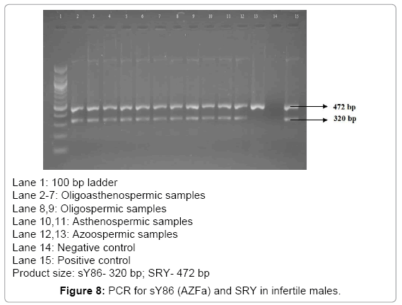 fertilization-in-vitro-sY86
