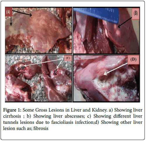 foodmicrobiology-bacterial-Liver-Kidney