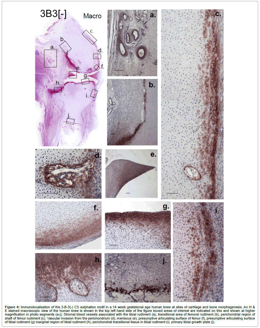 glycobiology-sulphation-motif-gestational-age-knee