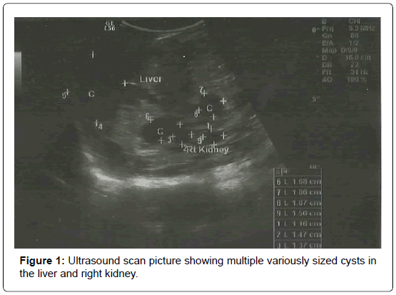 gynecology-Ultrasound-scan