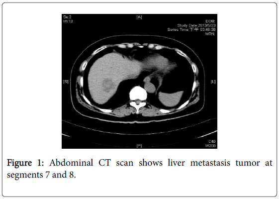 gynecology-obstetrics-Abdominal-CT-scan