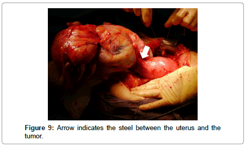 gynecology-obstetrics-Arrow-indicates