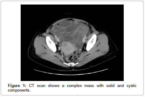 gynecology-obstetrics-CT-scan