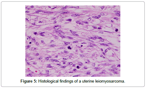 gynecology-obstetrics-Histological-findings