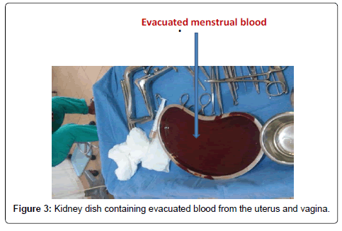 gynecology-obstetrics-Kidney-dish