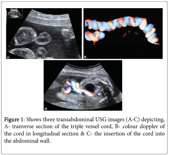 gynecology-patient-transabdominal-USG-images