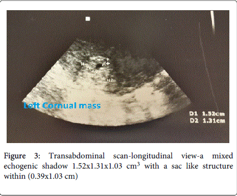 gynecology-scan-longitudinal