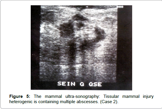 gynecology-ultra-sonography