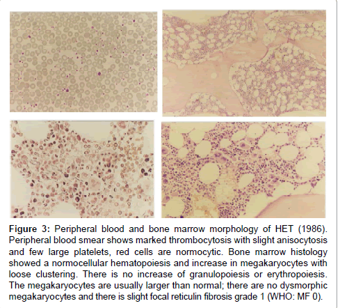 haematology-thromboembolic-diseases-Peripheral-blood