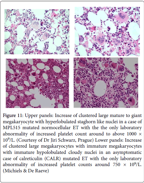haematology-thromboembolic-diseases-Upper-panels