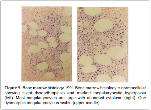 haematology-thromboembolic-diseases-abundant-cytplasm