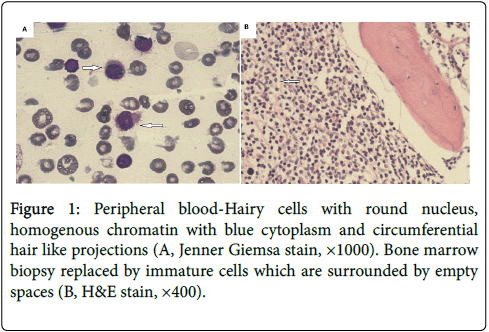 haematology-thromboembolic-diseases-blood-Hairy