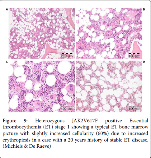 haematology-thromboembolic-diseases-bone-marrow
