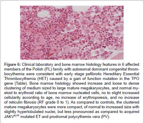 haematology-thromboembolic-diseases-marrow-histology