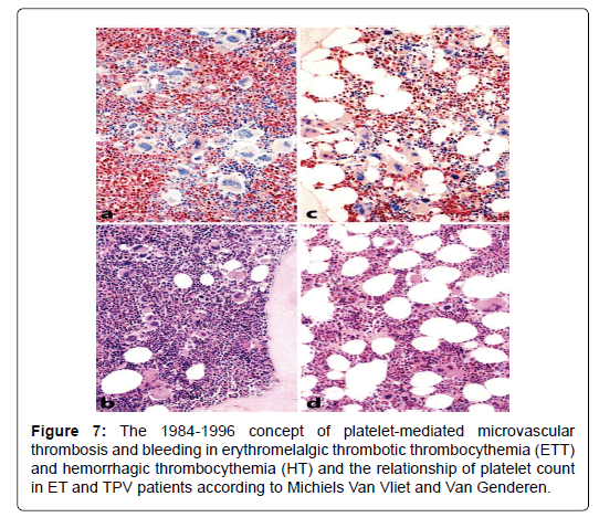 haematology-thromboembolic-platelet-mediated