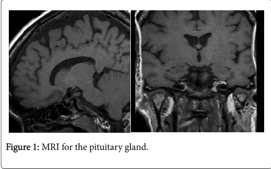 internal-medicine-pituitary-gland