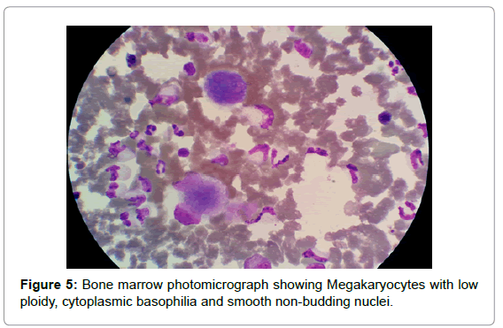 leukemia-non-budding-nuclei