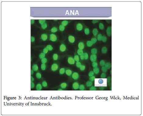 lupus-Antinuclear-Antibodies