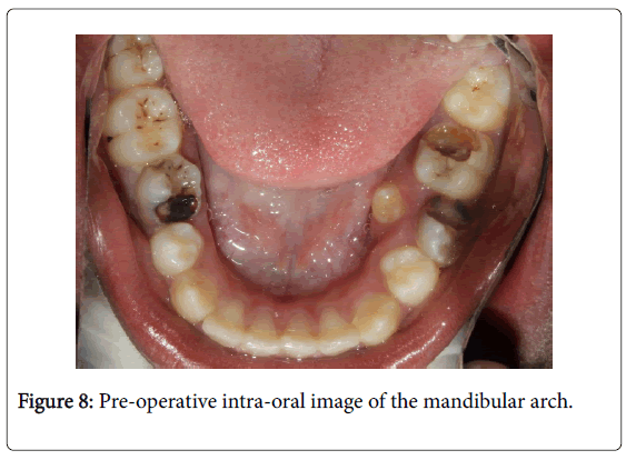 medical-surgical-pathology-Pre-operative-intra-oral-mandibular-arch