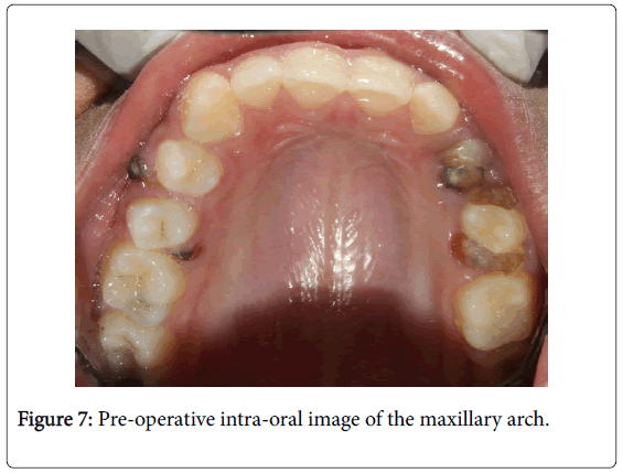 medical-surgical-pathology-Pre-operative-intra-oral-maxillary-arch