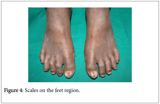 medical-surgical-pathology-Scales-feet-region