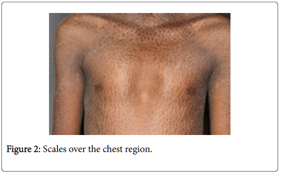 medical-surgical-pathology-Scales-over-chest-region