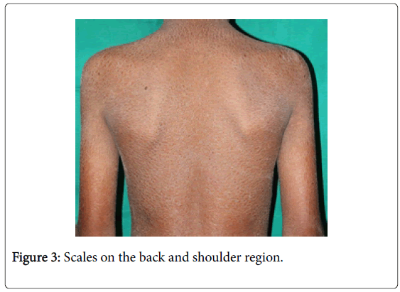 medical-surgical-pathology-back-shoulder-region